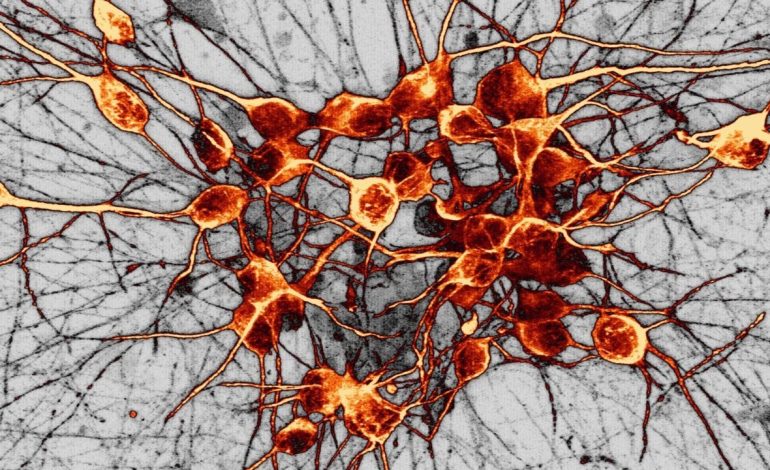 Otak Suka Kejutan Kecil Rahasia Dopamin dan Novelty