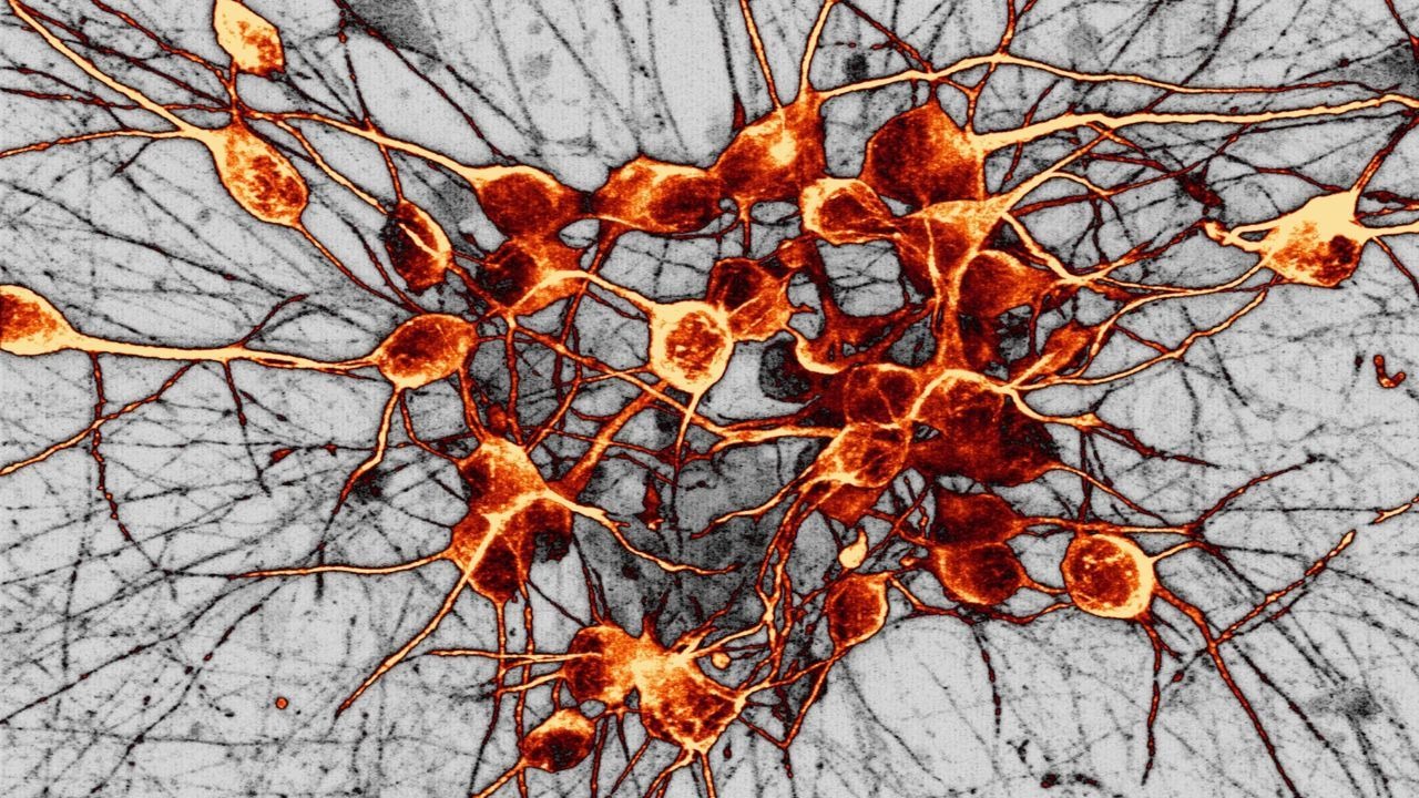 Otak Suka Kejutan Kecil Rahasia Dopamin dan Novelty